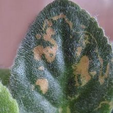 Ictericia