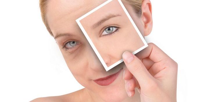 Deshágase de un hematoma en un día con consejos simples
