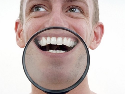 Cómo lidiar con manchas blancas en los dientes