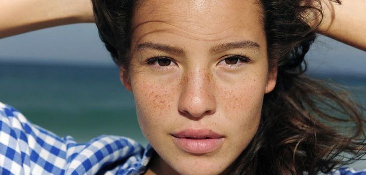 Cómo deshacerse de las pecas para siempre: los medios probados en casa