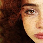 ¿Cómo deshacerse de las pecas?