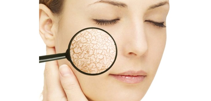 Aceites, mascarillas y cremas para pieles secas