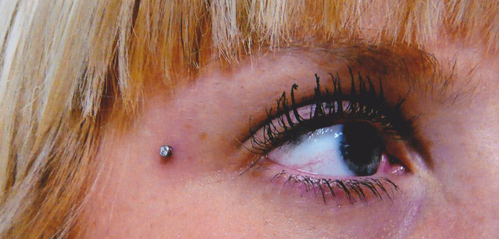 Perforación microdermal: cómo se hacen microdermabras (foto)