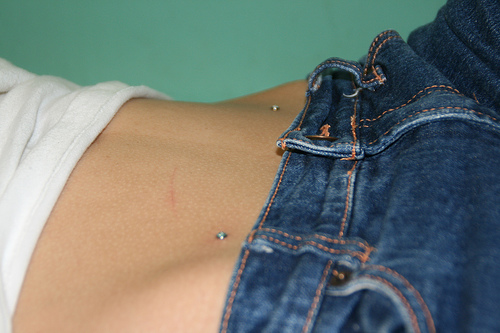 Perforación microdermal: cómo se hacen microdermabras (foto)