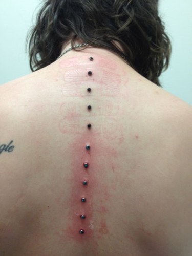 Perforación microdermal: cómo se hacen microdermabras (foto)
