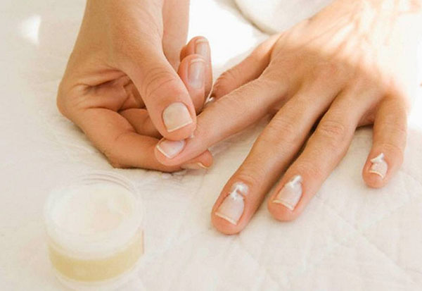 Cinco problemas frecuentes en las uñas: causas y soluciones