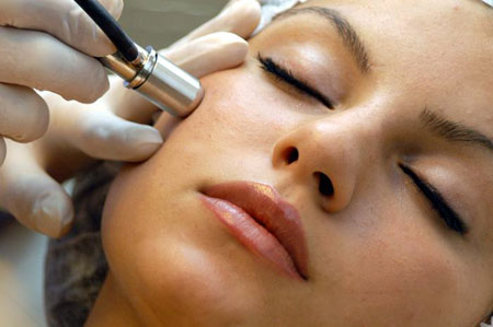  Microdermabrasión