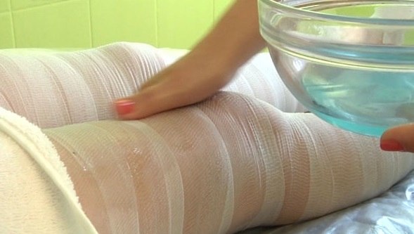Tratamiento de la aterosclerosis con remedios caseros