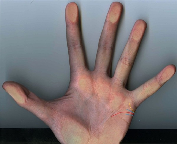 La línea de matrimonio en la mano