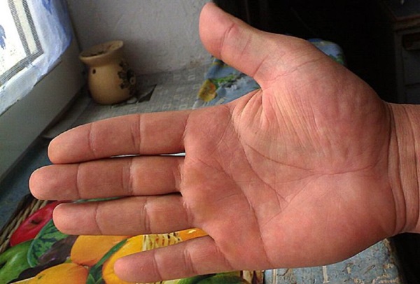 La línea de matrimonio en la mano