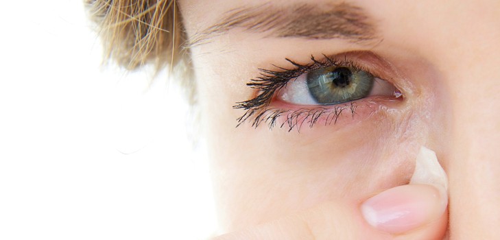 Qué hacer si pica en las comisuras de los ojos