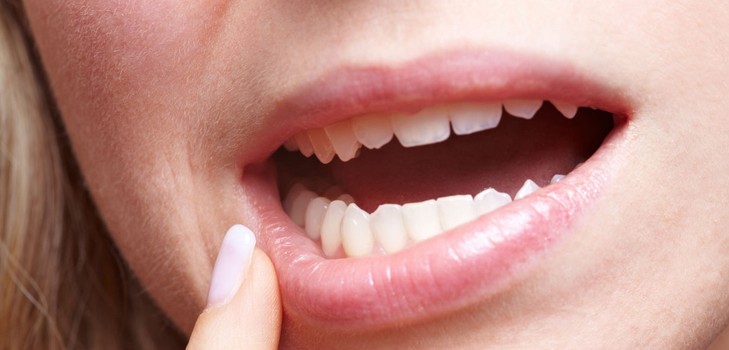 Por qué pica los dientes en un adulto
