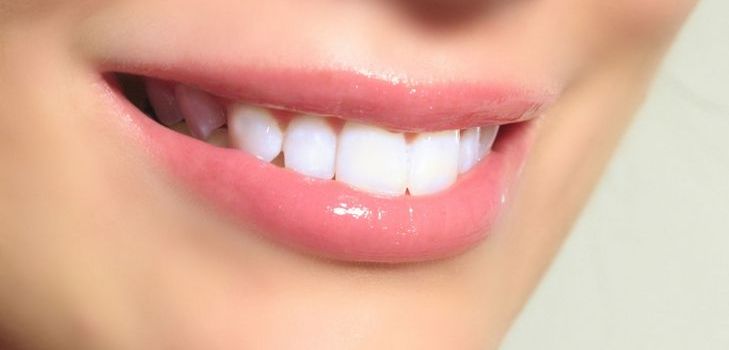 ¿La implantación dental es un lujo o una necesidad? 