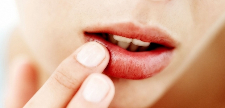 recetas para tratar los resfriados en los labios