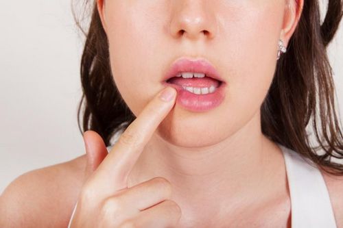 recetas para tratar los resfriados en los labios