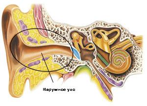 ¿Cómo tratar la otitis en el hogar?