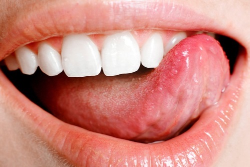 Cómo curar el dolor en la punta de la lengua