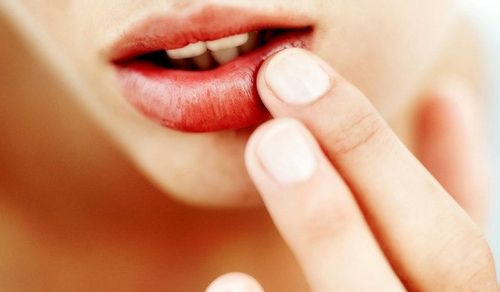  Una manera rápida y efectiva de tratar los resfriados en los labios: recetas sencillas