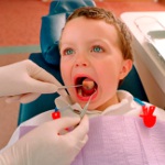 Cómo curar la estomatitis