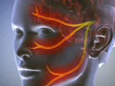 Neuralgia: síntomas, fotos, tratamiento