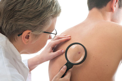Marcas de nacimiento en el cuerpo y sus peligros