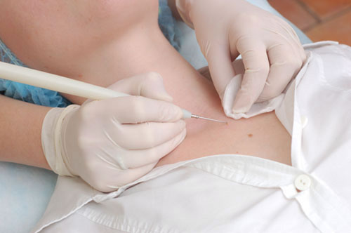 Marcas de nacimiento en el cuerpo y sus peligros