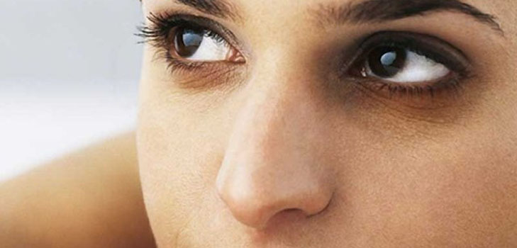 Remedio para hematomas debajo de los ojos
