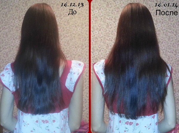 Vitaminas para el crecimiento del cabello y las uñas
